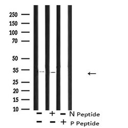Invitrogen Phospho-CDK1 (Thr161) Polyclonal Antibody 100 &mu;L; Unconjugated:Antibodies,