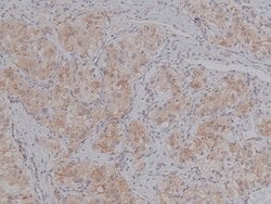 Invitrogen Phospho-BACE1 (Ser498) Polyclonal Antibody 100 μL; Unconjugated:Antibodies,