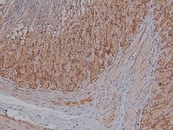 Invitrogen Phospho-BACE1 (Ser498) Polyclonal Antibody 100 μL; Unconjugated:Antibodies,