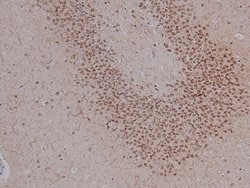 Invitrogen Phospho-CtIP (Ser327) Polyclonal Antibody 100 μL; Unconjugated:Antibodies,