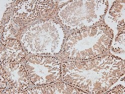 Invitrogen Phospho-DNA-PK (Thr2609) Polyclonal Antibody 100 &mu;L; Unconjugated:Antibodies,