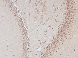 Invitrogen Phospho-DNA-PK (Thr2609) Polyclonal Antibody 100 &mu;L; Unconjugated:Antibodies,