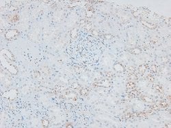 Invitrogen Phospho-IRAK1 (Thr387) Polyclonal Antibody 100 &mu;L; Unconjugated:Antibodies,