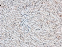 Invitrogen Phospho-IRAK1 (Thr387) Polyclonal Antibody 100 &mu;L; Unconjugated:Antibodies,