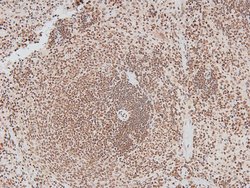 Invitrogen Phospho-IRAK1 (Thr387) Polyclonal Antibody 100 &mu;L; Unconjugated:Antibodies,