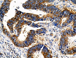 Invitrogen Phospho-NFATC1 (Ser294) Polyclonal Antibody 100 &mu;L; Unconjugated:Antibodies,