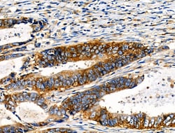 Invitrogen Phospho-NFATC1 (Ser294) Polyclonal Antibody 100 &mu;L; Unconjugated:Antibodies,