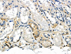 Invitrogen Phospho-NFATC1 (Ser294) Polyclonal Antibody 100 &mu;L; Unconjugated:Antibodies,