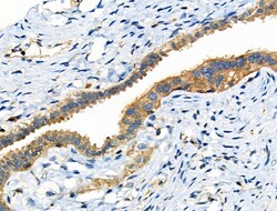 Invitrogen Phospho-NFATC1 (Ser294) Polyclonal Antibody 100 &mu;L; Unconjugated:Antibodies,