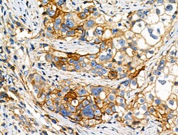 Invitrogen Phospho-NFATC1 (Ser294) Polyclonal Antibody 100 &mu;L; Unconjugated:Antibodies,