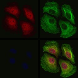 Invitrogen Phospho-NFkB p105 (Ser923) Polyclonal Antibody 100 &mu;L; Unconjugated:Antibodies,