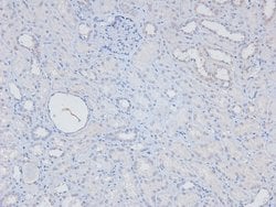 Invitrogen Phospho-NFkB p105 (Ser923) Polyclonal Antibody 100 &mu;L; Unconjugated:Antibodies,