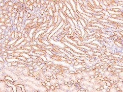 Invitrogen Phospho-NFkB p105 (Ser923) Polyclonal Antibody 100 &mu;L; Unconjugated:Antibodies,