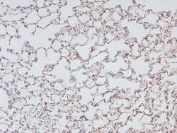 Invitrogen Phospho-NFkB p105 (Ser923) Polyclonal Antibody 100 &mu;L; Unconjugated:Antibodies,