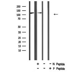Invitrogen Phospho-NFkB p105 (Ser923) Polyclonal Antibody 100 &mu;L; Unconjugated:Antibodies,