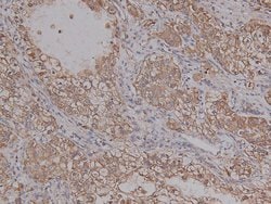 Invitrogen Phospho-PKA alpha (Ser339) Polyclonal Antibody 100 &mu;L | Buy Online | Invitrogen&trade; | Fisher Scientific