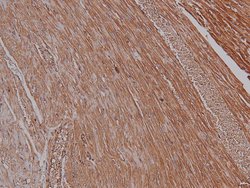 Invitrogen Phospho-PKA alpha (Ser339) Polyclonal Antibody 100 &mu;L | Buy Online | Invitrogen&trade; | Fisher Scientific