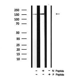 Invitrogen Phospho-PLCG2 (Tyr759) Polyclonal Antibody 100 &mu;L; Unconjugated:Antibodies,