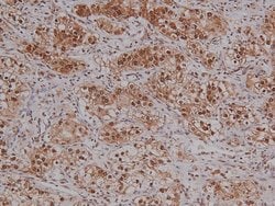 Invitrogen Phospho-VAV1 (Tyr160) Polyclonal Antibody 100 &mu;L | Buy Online | Invitrogen&trade; | Fisher Scientific