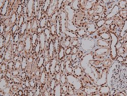 Invitrogen Phospho-VEGF Receptor 2 (Tyr996) Polyclonal Antibody 100 &mu;L;