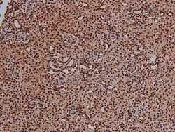 Invitrogen Phospho-VEGF Receptor 2 (Tyr996) Polyclonal Antibody 100 &mu;L;