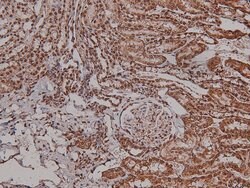 Invitrogen Phospho-VEGF Receptor 2 (Tyr996) Polyclonal Antibody 100 &mu;L;