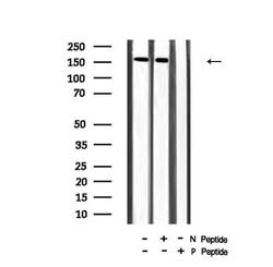 Invitrogen Phospho-VEGF Receptor 2 (Tyr996) Polyclonal Antibody 100 &mu;L;
