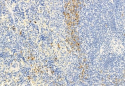 Invitrogen Phospho-HSL (Ser660) Polyclonal Antibody 100 &mu;L; Unconjugated:Antibodies,