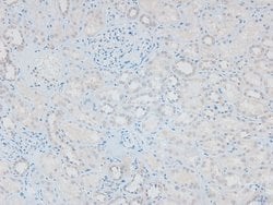 Invitrogen Phospho-HSL (Ser660) Polyclonal Antibody 100 &mu;L; Unconjugated:Antibodies,