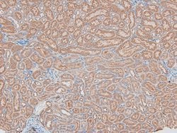 Invitrogen Phospho-HSL (Ser660) Polyclonal Antibody 100 &mu;L; Unconjugated:Antibodies,