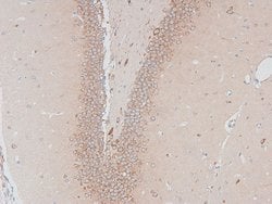 Invitrogen Phospho-HSL (Ser660) Polyclonal Antibody 100 &mu;L; Unconjugated:Antibodies,