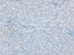 Invitrogen Phospho-PKC beta (Ser661) Polyclonal Antibody 100 &mu;L; Unconjugated:Antibodies,