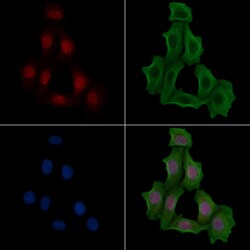 Invitrogen Phospho-TLK1 (Ser741) Polyclonal Antibody 100 &mu;L; Unconjugated:Antibodies,