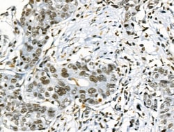 Invitrogen Phospho-TLK1 (Ser741) Polyclonal Antibody 100 &mu;L; Unconjugated:Antibodies,