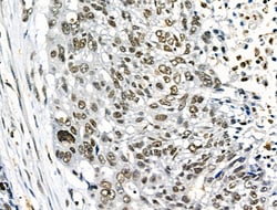 Invitrogen Phospho-TLK1 (Ser741) Polyclonal Antibody 100 &mu;L; Unconjugated:Antibodies,
