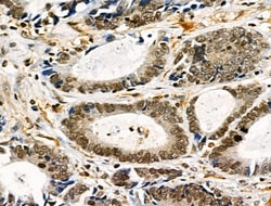 Invitrogen Phospho-TLK1 (Ser741) Polyclonal Antibody 100 &mu;L; Unconjugated:Antibodies,