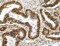 Invitrogen Phospho-TLK1 (Ser741) Polyclonal Antibody 100 &mu;L; Unconjugated:Antibodies,