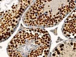 Invitrogen Phospho-TLK1 (Ser741) Polyclonal Antibody 100 &mu;L; Unconjugated:Antibodies,