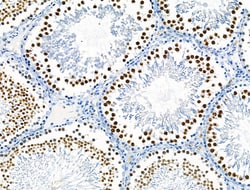 Invitrogen Phospho-TLK1 (Ser741) Polyclonal Antibody 100 &mu;L; Unconjugated:Antibodies,