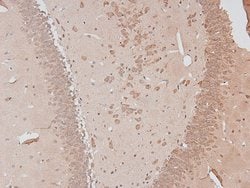 Invitrogen Phospho-B-Myb (Thr494) Polyclonal Antibody 100 &mu;L; Unconjugated:Antibodies,
