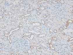 Invitrogen&trade;&nbsp;Phospho-MAP2K1/MAP2K2 (Ser218, Ser222, Ser226) Polyclonal Antibody