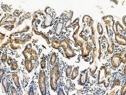 Invitrogen Phospho-GP130 (Ser782) Polyclonal Antibody 100 &mu;L; Unconjugated:Antibodies,