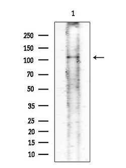Invitrogen Phospho-FES (Tyr713) Polyclonal Antibody 100 &mu;L | Buy Online | Invitrogen&trade; | Fisher Scientific