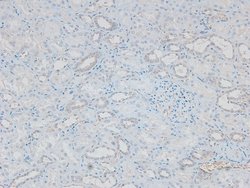 Invitrogen Phospho-FES (Tyr713) Polyclonal Antibody 100 &mu;L | Buy Online | Invitrogen&trade; | Fisher Scientific