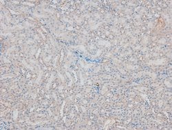 Invitrogen Phospho-FES (Tyr713) Polyclonal Antibody 100 &mu;L | Buy Online | Invitrogen&trade; | Fisher Scientific