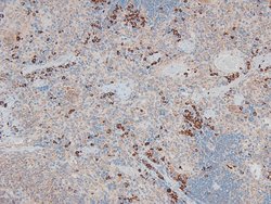 Invitrogen Phospho-FES (Tyr713) Polyclonal Antibody 100 &mu;L | Buy Online | Invitrogen&trade; | Fisher Scientific