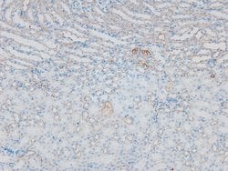 Phospho-CFTR (Ser737) Polyclonal Antibody:Antibodies, Polyclonal