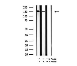 Phospho-CFTR (Ser737) Polyclonal Antibody:Antibodies, Polyclonal