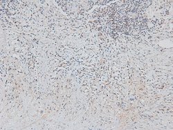 Invitrogen Phospho-Cyclin D1 (Ser90) Polyclonal Antibody 100 &mu;L | Buy Online | Invitrogen&trade; | Fisher Scientific