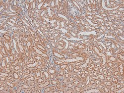 Invitrogen Phospho-Cyclin D1 (Ser90) Polyclonal Antibody 100 &mu;L | Buy Online | Invitrogen&trade; | Fisher Scientific